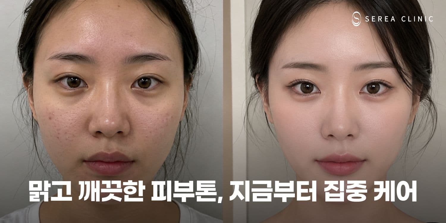 💎 피부톤·색소 고민을 위한 프리미엄 레이저 케어