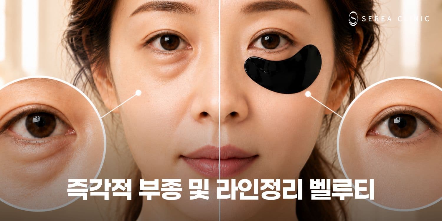 🚫 흡입하지마세요. 충격파로 녹이세요.