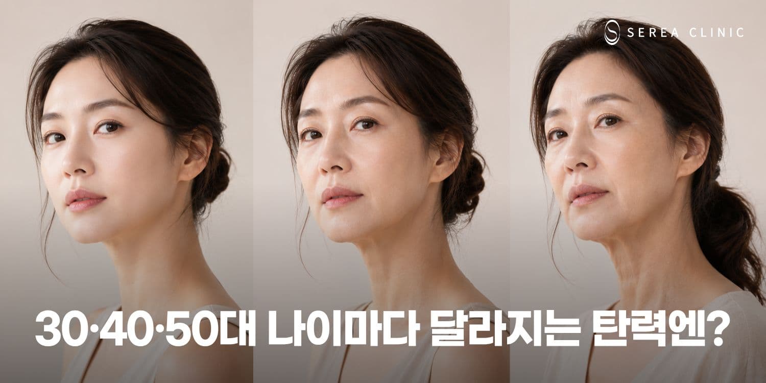 📈 30대·40대·50대 탄력 관리의 시작 써마지리프팅